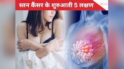 Breast Cancer Symptoms: स्तन कैंसर के शुरुआती 5 लक्षण, इन्हें भूलकर भी न करें इग्नोर