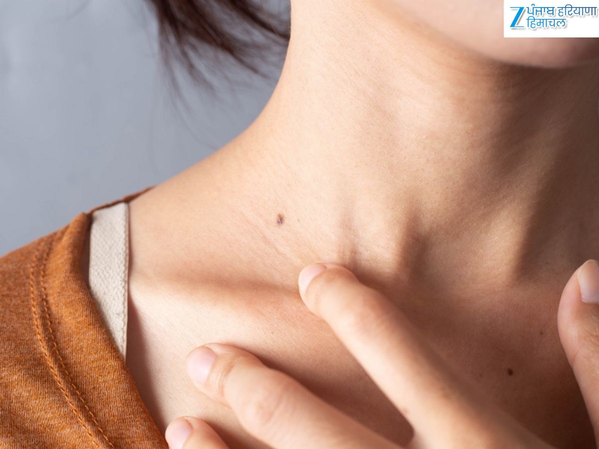 Mole va yalangoch odam Mole va yalangoch odam