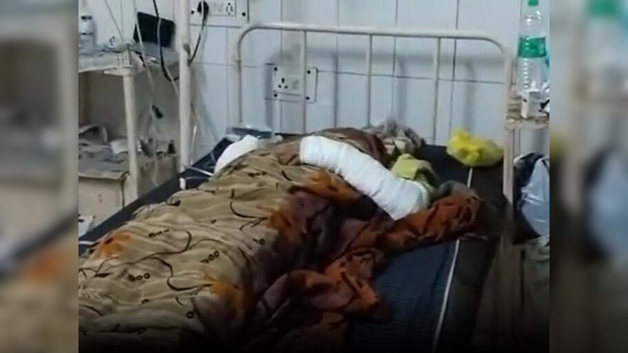 MP News: शादी करने से किया मना, तो जेठ ने घर में घुसकर फेंका तेजाब
