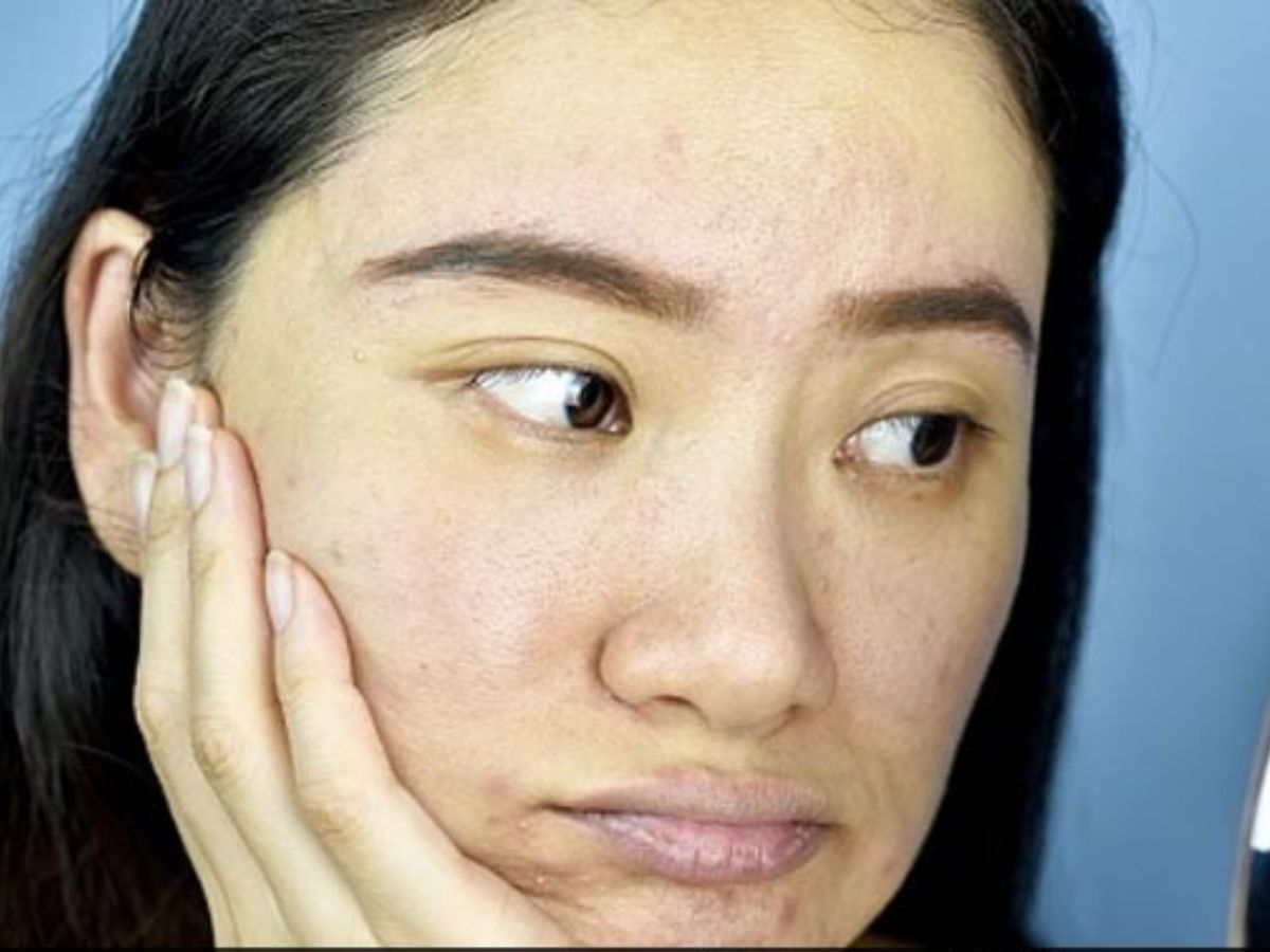 ड्राई स्किन