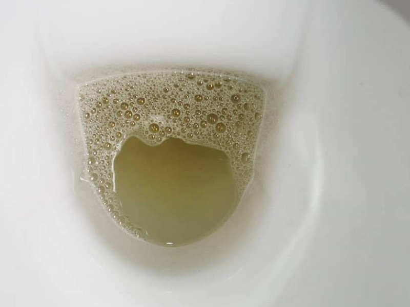 पेशाब के रंग में बदलाव 