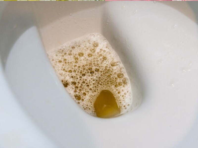 पेशाब में झाग 