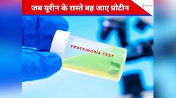 पेशाब के रास्ते बह जाता है प्रोटीन, तो इसे हल्के में न लें, अपनाएं 3 जबरदस्त नुस्खे
