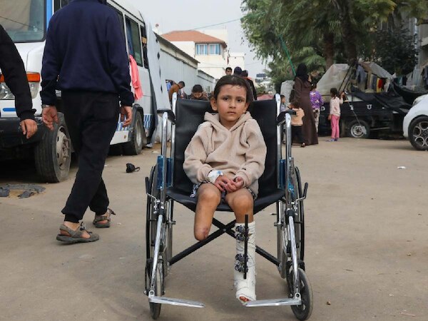 6000 से ज्यादा लोगों के काटने पड़े अंग, 24% से ज्यादा बच्चे; Gaza पर चौंकाने वाला खुलासा