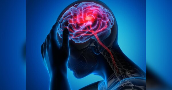Tingling to seizures these symptoms can be signs of Weak brain nerves ...