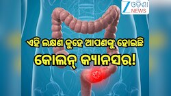 Colon Cancer: କୋଲନ୍ କ୍ୟାନସର ହେବା ପୂର୍ବରୁ ଶରୀରରେ ଦେଖାଦିଏ ଏହି୭ ଲକ୍ଷଣ!କରନ୍ତୁନି ଅବହେଳା,ନ