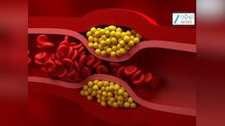 Bad Cholesterol: ଆମେରିକୀୟ ହୃଦରୋଗ ବିଶେଷଜ୍ଞ କହିଲେ ବଡ କଥା