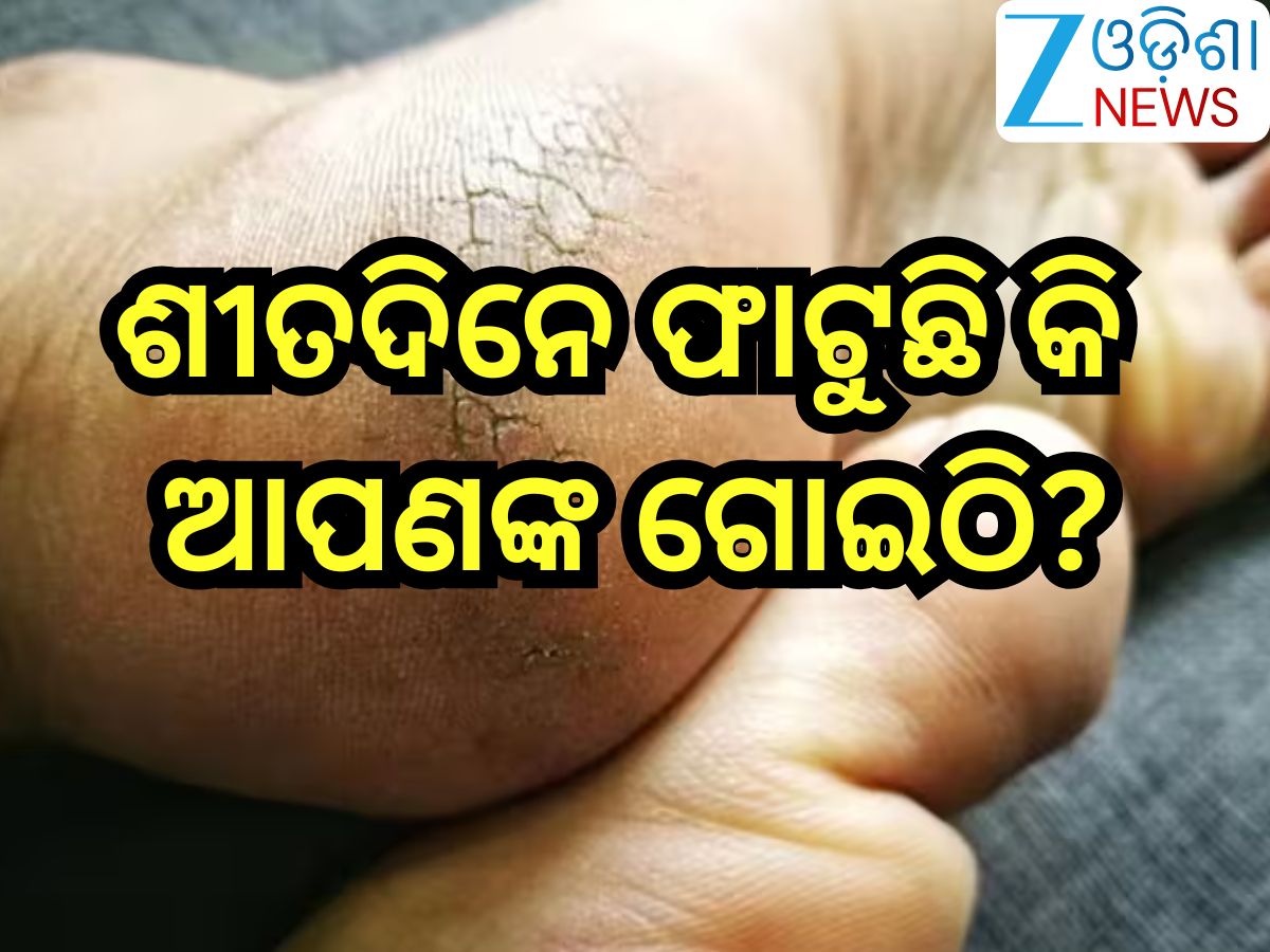 Health Tips: ଶୀତଦିନେ ଫାଟୁଛି କି ଆପଣଙ୍କ ଗୋଇଠି,ଆପଣାଙ୍କୁ ଏହିସବୁ ଘରୋଇ ଉପଚାର Health Tips: ଶୀତଦିନେ ଫାଟୁଛି କି ଆପଣଙ୍କ ଗୋଇଠି,ଆପଣାଙ୍କୁ ଏହିସବୁ ଘରୋଇ ଉପଚାର