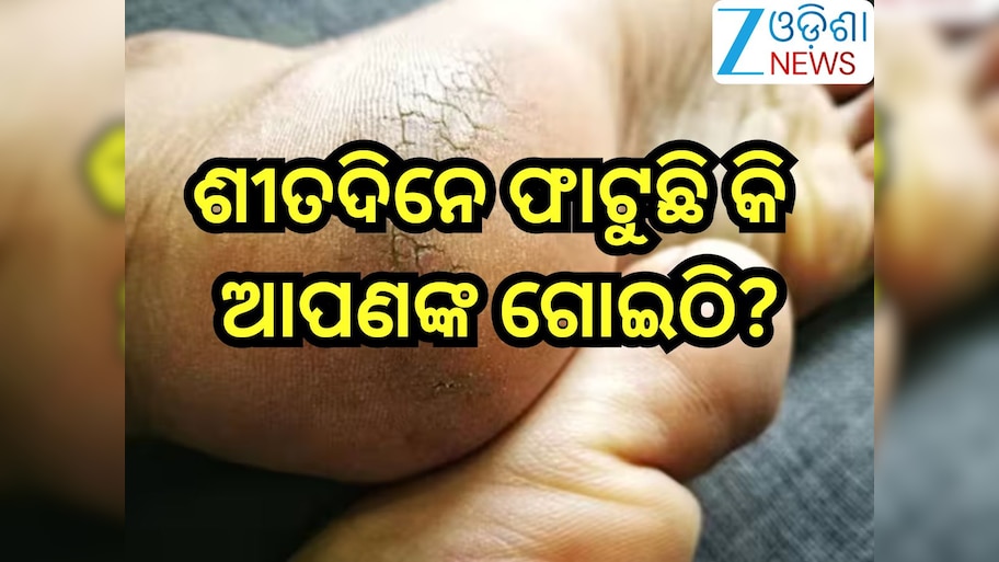 Health Tips: ଶୀତଦିନେ ଫାଟୁଛି କି ଆପଣଙ୍କ ଗୋଇଠି,ଆପଣାଙ୍କୁ ଏହିସବୁ ଘରୋଇ ଉପଚାର