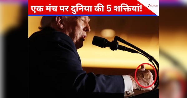 ट्रंप के हाथों पर बैंडेड क्यों लगी है? मीडिया में चल ही अफवाहों के बाद व्हाइट हाउस ने चुप्पी तोड़ी