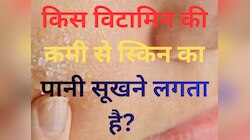 Trending Quiz: किस विटामिन की कमी से स्किन का पानी सूखने लगता है?