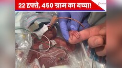 22 हफ्ते में जन्मा 450 ग्राम का बच्चा! कैसे डॉक्टरों ने नामुमकिन को कर दिखाया मुमकिन