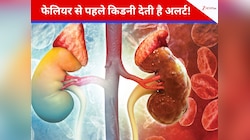 फेलियर से पहले किडनी देती है अलर्ट! इन लक्षणों को इग्नोर करना पड़ सकता है भारी