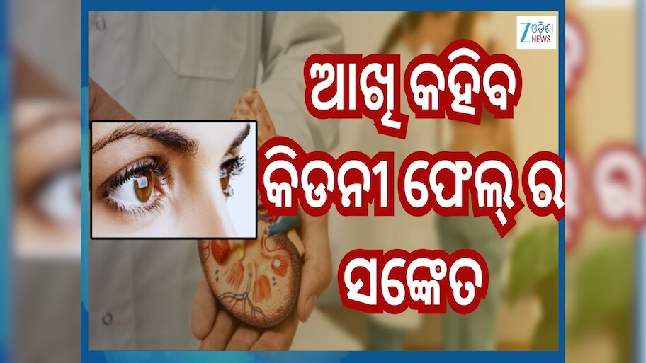 Kidney Damage Symptoms: ଆଖିରୁ ଜଣାପଡ଼େ କିଡନୀ ଫେଲ୍ ହେବାର ଏସବୁ ସଙ୍କେତ...ଜାଣିବା ମାତ୍ରେ ହୁଅନ୍ତୁ ସାବଧାନ