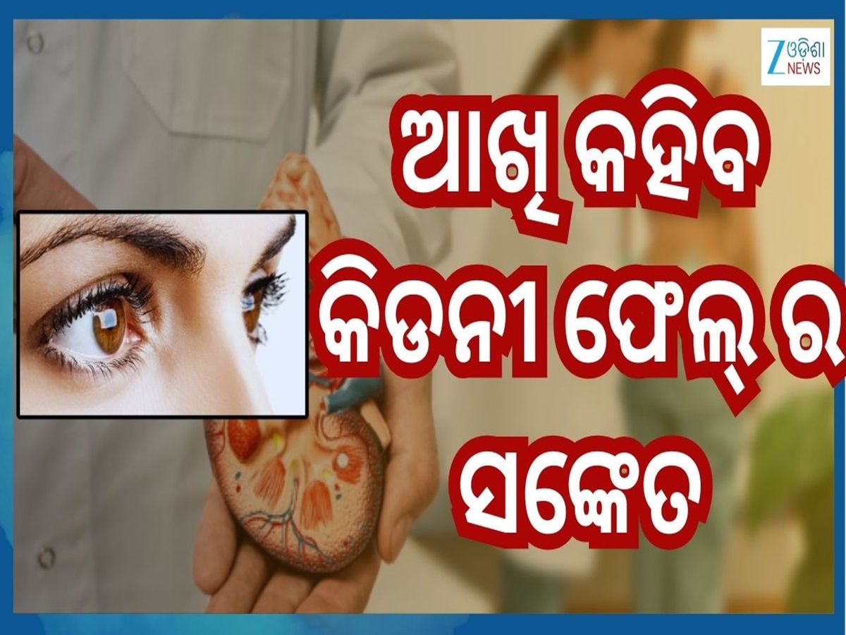 Kidney Damage Symptoms: ଆଖିରୁ ଜଣାପଡ଼େ କିଡନୀ ଫେଲ୍ ହେବାର ଏସବୁ ସଙ୍କେତ...ଜାଣିବା ମାତ୍ରେ ହୁଅନ୍ତୁ ସାବଧାନ Kidney Damage Symptoms: ଆଖିରୁ ଜଣାପଡ଼େ କିଡନୀ ଫେଲ୍ ହେବାର ଏସବୁ ସଙ୍କେତ...ଜାଣିବା ମାତ୍ରେ ହୁଅନ୍ତୁ ସାବଧାନ