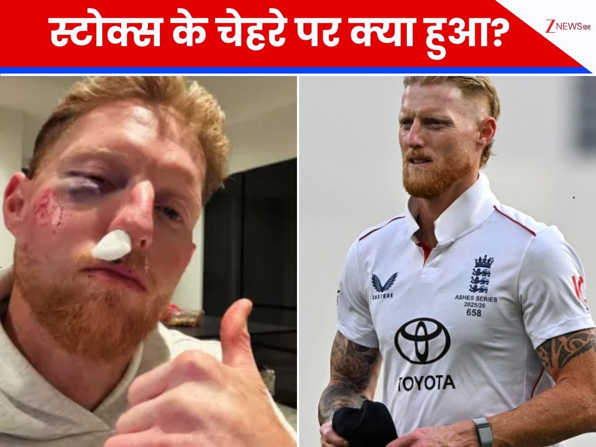 बेन स्टोक्स को ये क्या हुआ? खून, खरोंच और सूजन... बुरी तरह जख्मी हुआ इंग्लैंड का कप्तान बेन स्टोक्स को ये क्या हुआ? खून, खरोंच और सूजन... बुरी तरह जख्मी हुआ इंग्लैंड का कप्तान