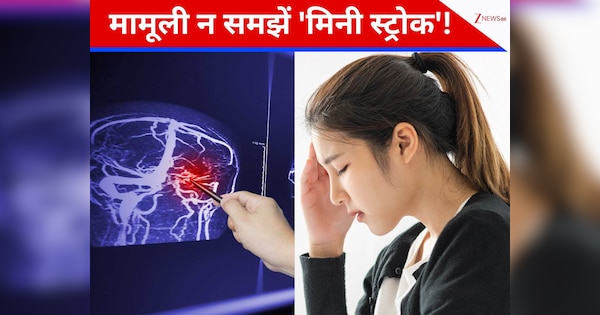 अलर्ट! बस मिनटों की ये दिक्कत बन सकती है \'ब्रेन स्ट्रोक\' का कारण, इन 7 लक्षणों को इग्नोर करना पड़ सकता है भारी