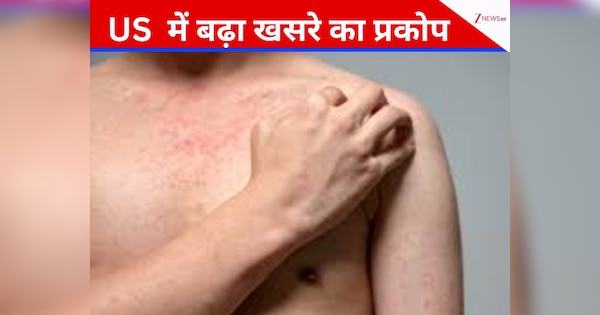 ट्रंप टैरिफ-टैरिफ खेलते रहे और US में इस बीमारी ने मचा दी तबाही, बंद करने पड़े कॉलेज