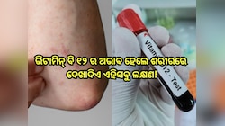 Vitamin B12 Deficiency: ଶରୀରରେ ଭିଟାମିନ୍ ବି ୧୨ ର ଅଭାବ ହେଲେ ଦେଖାଦିଏ ଏହିସବୁ ଲକ୍ଷଣ,କରନ୍ତ