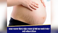 ਗਰਭ ਅਵਸਥਾ ਦੌਰਾਨ ਸਟ੍ਰੈਚ ਮਾਰਕਸ ਨੂੰ ਕਿਵੇਂ ਕਰ ਸਕਦੇ ਹੋ ਘੱਟ? ਜਾਣੋ ਮਾਹਿਰ ਦੇ ਟਿਪਸ