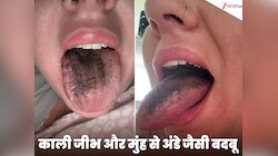 शादी से पहले दुबले होने के चक्कर में काली पड़ गई जीभ, गंवाना पड़ा शरीर का ये अंग!