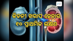 kidney Damage Symptos: କିଡନୀ ଖରାପ ହେବାର ପ୍ରାଥମିକ ୧୦ଟି ଲକ୍ଷଣ