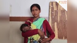 सिस्टम की बड़ी लापरवाही! कहीं बिना कान के जन्मी बच्ची, तो कहीं बच्चे की मौत