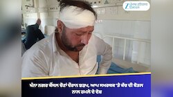 ਖੰਨਾ ਨਗਰ ਕੌਂਸਲ ਚੋਣਾਂ ਦੌਰਾਨ ਝੜਪ, ਆਪ ਸਮਰਥਕ ‘ਤੇ ਕੱਚ ਦੀ ਬੋਤਲ ਨਾਲ ਹਮਲੇ ਦੇ ਦੋਸ਼