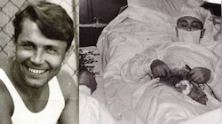 शीशा देखकर खुद ही कर दिया अपना ऑपरेशन, डॉक्टर ने बिना एनेस्थीसिया निकाला अपेंडिक्स
