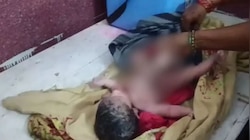 MP में चार हाथ-चार पैर वाले बच्चे का जन्म...देखने के लिए अस्पताल में जुटी भीड़
