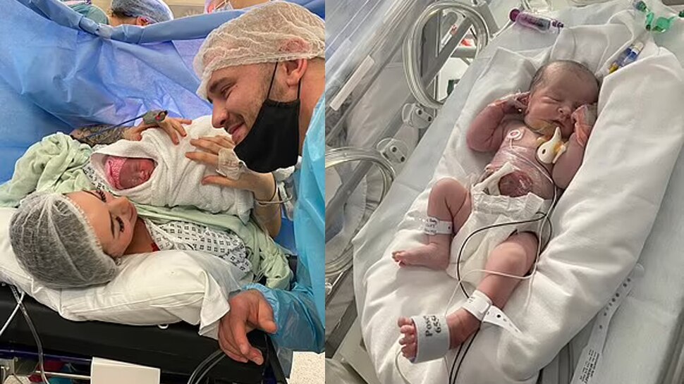 Baby born with her Intestines outside of her stomach