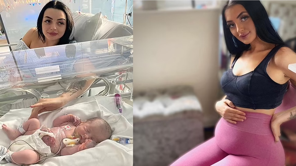 Baby born with her Intestines outside of her stomach