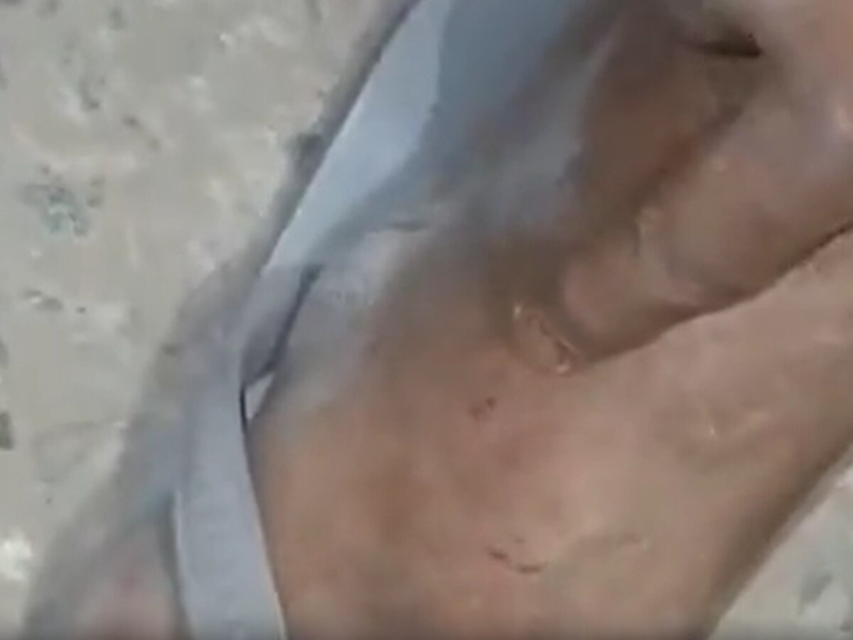 Russell Viper bit deepak twice angry young man took snake to the hospital