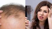 Hair Care: टूटते-झड़ते बालों की समस्या हो जाएगी छूमंतर! बस आज से शुरू करें ये आसान घरेलू उपाय