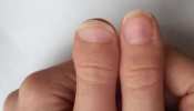 Thumb Palmistry: ऐसे अंगूठे वाले कमाते हैं खूब पैसा, जानें कितना लकी है आपका अंगूठा