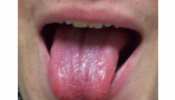 Tongue colour Palmistry: आपकी जीभ का रंग और बनावट बताती है छुपी खूबियां, जान सकते हैं करियर और कारोबर का भविष्य