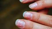 deficiency of vitamin B12 puts these harmful effects on nails