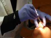Medical Negligence: डेंटिस्‍ट को दांतों में करना था काम, ब्रेन में किया छेद; मरीज की जान पर बन आई