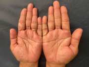 palmistry these line in your palm make you rich overnight