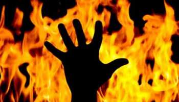 छत्तीसगढ़ः महिला सरपंच की बेटी को घर में घुसकर जिंदा जलाया, 70 प्रतिशत झुलसी नाबालिग छत्तीसगढ़ः महिला सरपंच की बेटी को घर में घुसकर जिंदा जलाया, 70 प्रतिशत झुलसी नाबालिग