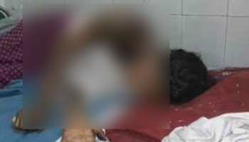 युवती ने किया छेड़छाड़ का विरोध तो जिंदा जलाया, परिजन बोले- 'शिकायत पर कार्रवाई होती तो...' युवती ने किया छेड़छाड़ का विरोध तो जिंदा जलाया, परिजन बोले- 'शिकायत पर कार्रवाई होती तो...'