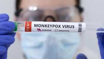 Monkeypox: क्या मीट खाने से हो सकता है मंकीपॉक्स? वायरस के बारे में ये बातें जान लेना बेहद जरूरी