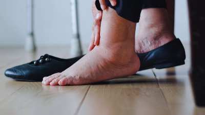 try these 5 home remedies to get rid of swollen feet