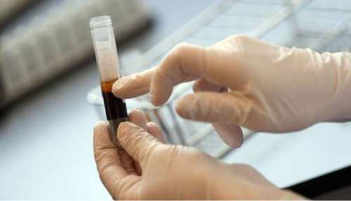 झारखंड: प्लाज्मा थेरेपी से कोरोना संक्रमण को मात देने की तैयारी, रिम्स बना डोनेशन सेंटर झारखंड: प्लाज्मा थेरेपी से कोरोना संक्रमण को मात देने की तैयारी, रिम्स बना डोनेशन सेंटर