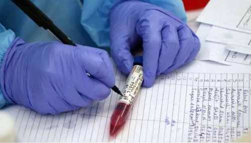 उत्तराखंड में RTPCR टेस्ट का रेट घटा, अब 1400 रुपये में होगी टेस्टिंग, जानें बाकी शुल्क उत्तराखंड में RTPCR टेस्ट का रेट घटा, अब 1400 रुपये में होगी टेस्टिंग, जानें बाकी शुल्क