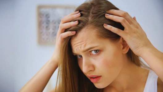 Follow these home remedies to get rid of dandruff in winter