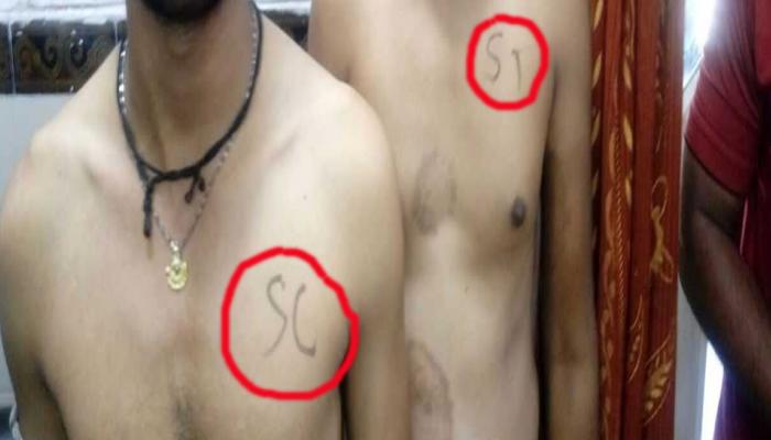 मध्य प्रदेश में दिखा गजब नजारा, मेडिकल टेस्ट को आए कैंडिडेट्स के सीने पर लिख दिया SC-ST मध्य प्रदेश में दिखा गजब नजारा, मेडिकल टेस्ट को आए कैंडिडेट्स के सीने पर लिख दिया SC-ST