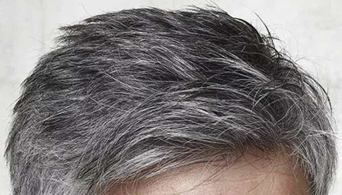 how to stop gray hair at early age | जवानी में सफेद होते बाल से आप भी हैं परेशान तो अपनाएं ये नुस्खे- Health News in Hindi how to stop gray hair at early age | जवानी में सफेद होते बाल से आप भी हैं परेशान तो अपनाएं ये नुस्खे- Health News in Hindi