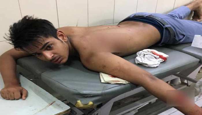 दिल्ली: स्कूल ग्राउंड में 10वीं के छात्र ने सीनियर पर किए चाकू से ताबड़तोड़ वार दिल्ली: स्कूल ग्राउंड में 10वीं के छात्र ने सीनियर पर किए चाकू से ताबड़तोड़ वार