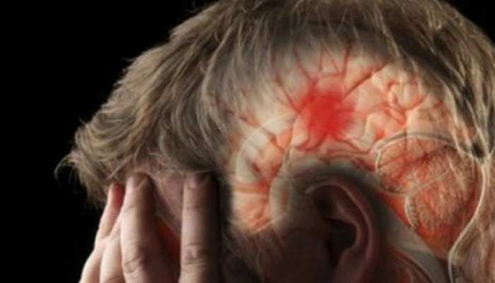 ब्रेन स्ट्रोक में सुनने-देखने की क्षमता खो देता है मरीज, दुनिया का हर छठा व्यक्ति है इसका शिकार ब्रेन स्ट्रोक में सुनने-देखने की क्षमता खो देता है मरीज, दुनिया का हर छठा व्यक्ति है इसका शिकार